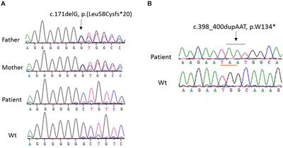 Molecular Analysis of CYP27B1 Mutations in Vitamin D-Dependent Rickets Type 1A: c.590G > A (p.G197D) Missense Mutation Causes a RNA Splicing Error